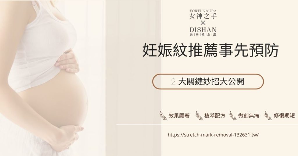 妊娠紋推薦事先預防