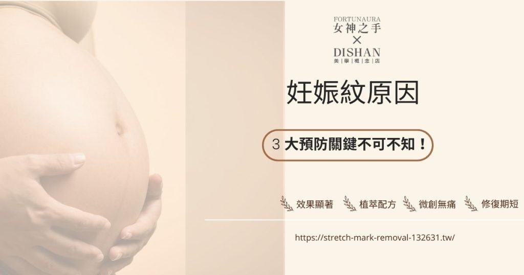 妊娠紋原因