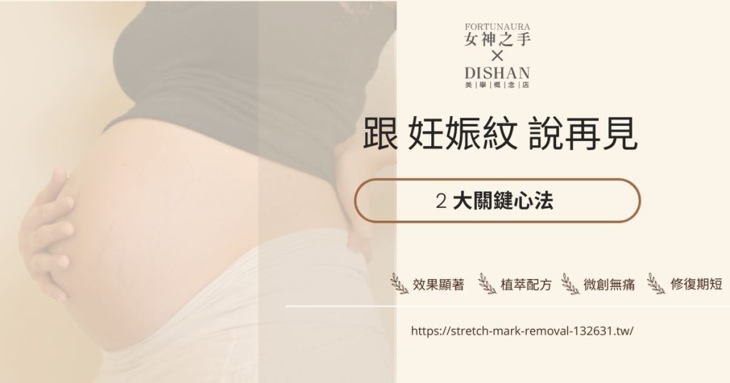 跟妊娠紋說再見