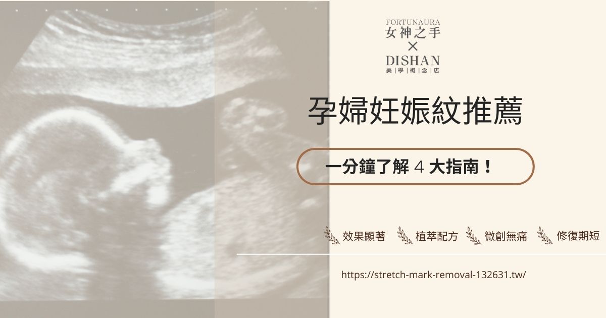 孕婦妊娠紋推薦