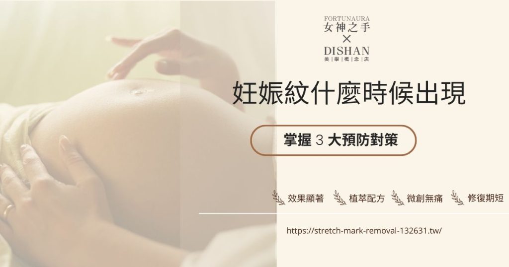 妊娠紋什麼時候出現