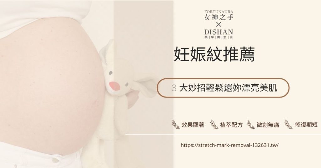 妊娠紋推薦