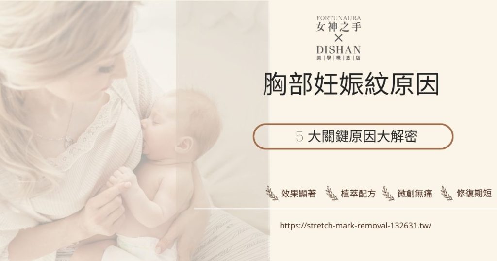 胸部妊娠紋原因 